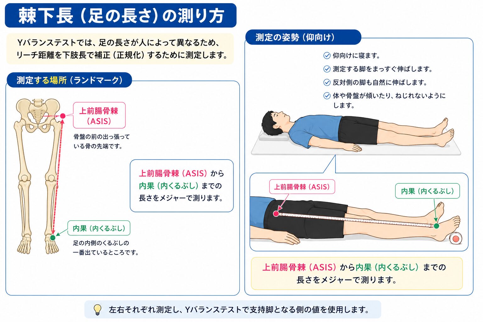 棘下長（足の長さ）の測り方の図解。仰向けに寝て、上前腸骨棘（ASIS）から内果（内くるぶし）までをメジャーで測る。測定場所・ランドマーク・測定姿勢を解説