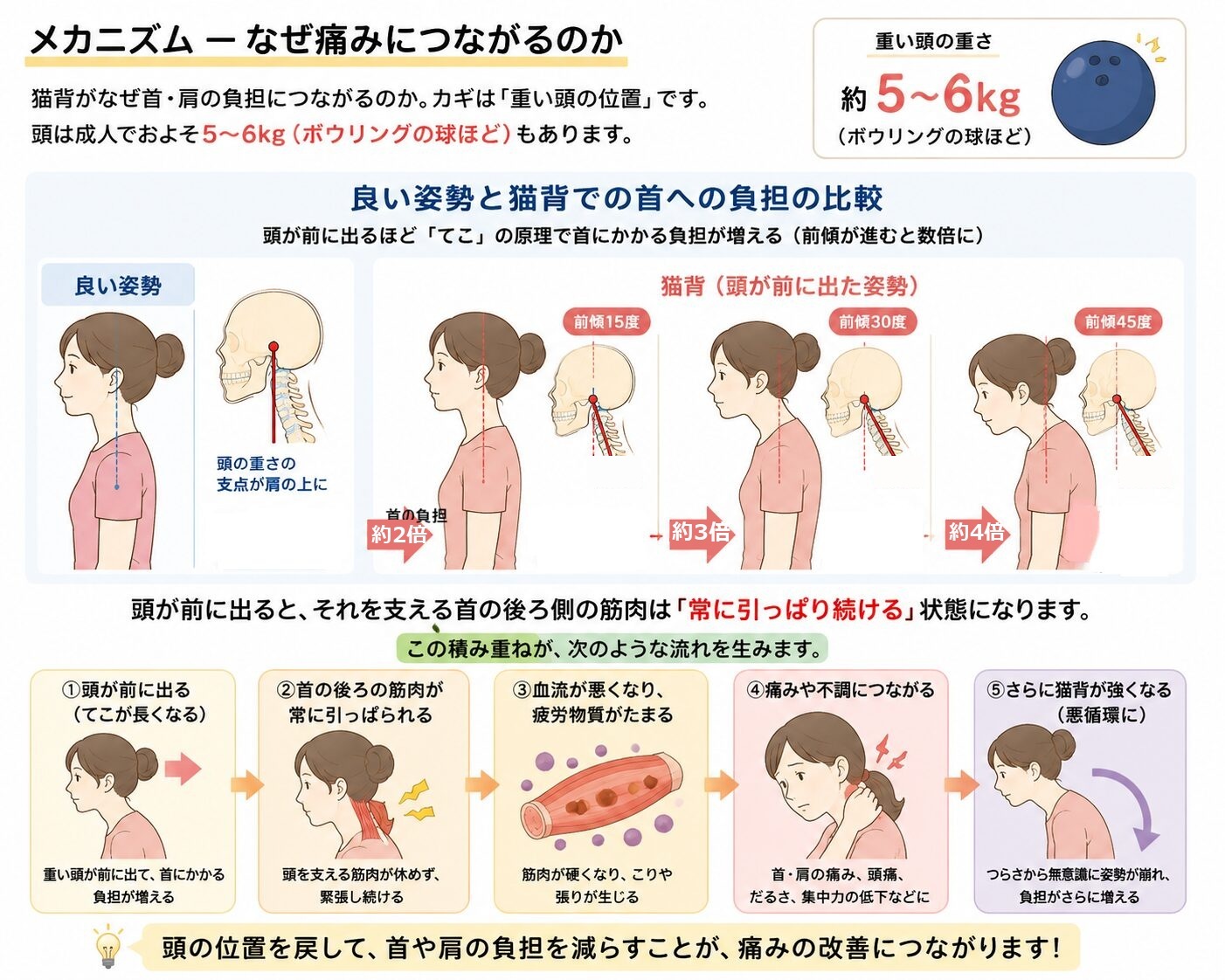 猫背のメカニズム：頭が前に出るほど「てこの原理」で首への負担が増える（前傾15度で約2倍、30度で約3倍、45度で約4倍）。①頭が前に出る→②首の後ろの筋肉が常に引っぱられる→③血流が悪くなり疲労物質がたまる→④痛みや不調につながる→⑤さらに猫背が強くなる悪循環に。